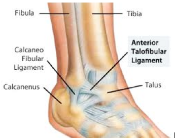 Ankle Instability El Paso  Ankle Ligament Injury El Paso